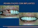 slideshow