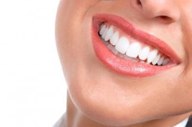  - DentalGN