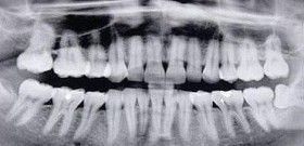 Visite-nos, ficamos a 5 min de carro da rotunda de Santo Ovídio - DentalGN