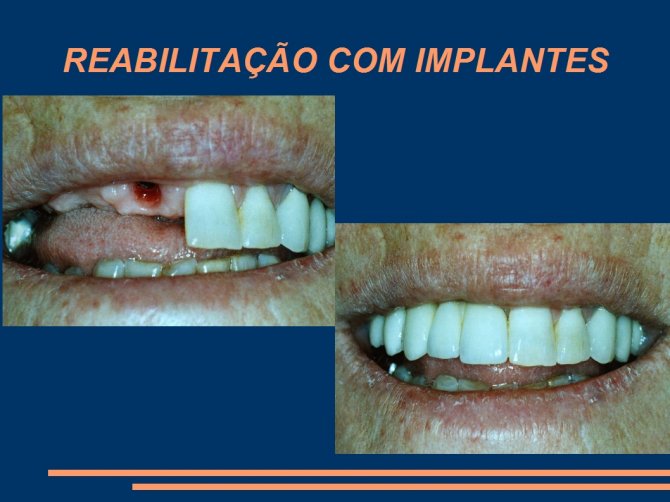  - DentalGN